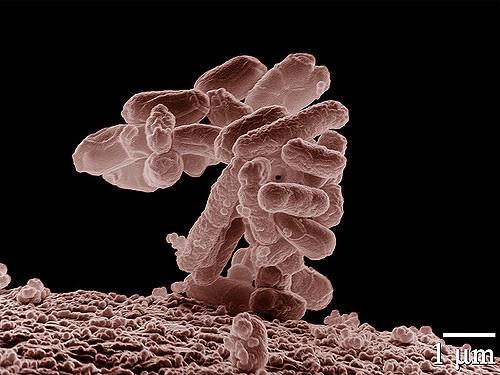 Enterohaemorrhagic E. coli (EHEC): E. coli O157:H7 is perhaps the best-known type of EHEC for its implications in hymolytic uremic syndrome.