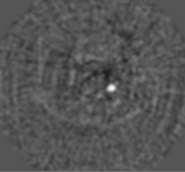 unenhanced polyp Axial : 120kVp 50mA