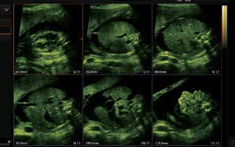 Fetal face Fetal