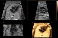 It allows you to promptly check fetal heart beating with realistic images.