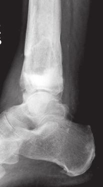 The radiographs are taken with the patient supine and