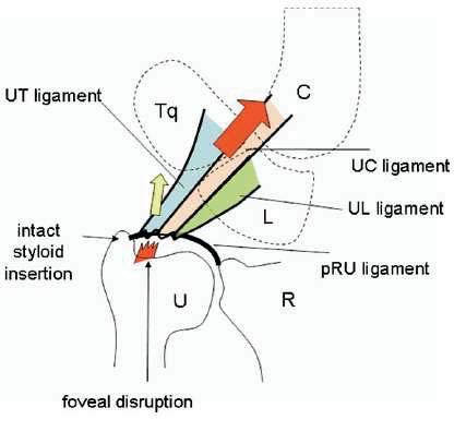 Anatomy correlates to Function Fovea Ulnaris as the CONVERGENT POINT D JHS 2008 Distal Component for the