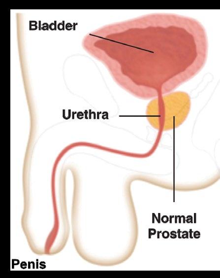 WHAT IS AN ENLARGED PROSTATE? The prostate is a male reproductive gland, about the size of a walnut, that produces fluid for semen.