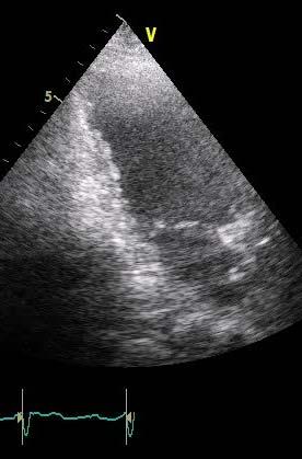 asymptomatic male with