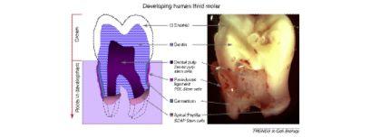 Volponi et al. Page 16 Figure II. Photograph and diagram of a human third molar tooth following extraction. A hemisected tooth showing the internal tissues is shown on the right.