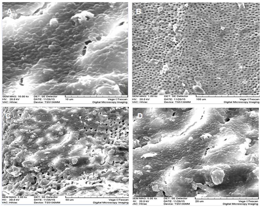 218 Forough Reyhani et al. Figure 1. SEM analysis of the development of E. faecalis biofilm on the surface of root canal dentin.