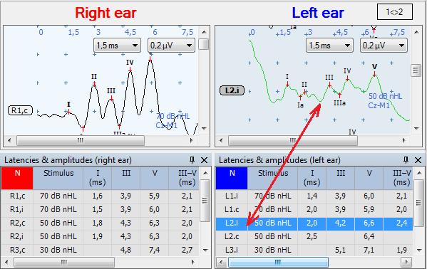 Neuro-Audio.NET (User Manual) When selecting (focusing) a trace the corresponding line in the quick analysis window table is automatically selected.