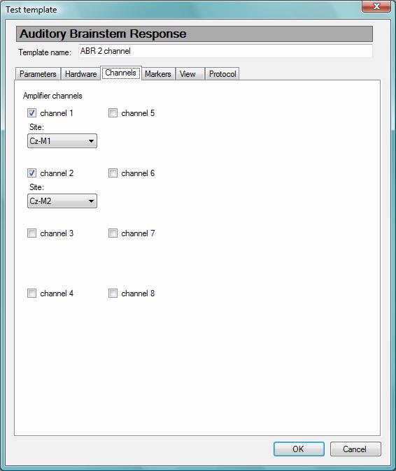 Program Settings 7.2.3. Channels This page (Fig. 7.12) is available for AEP tests only.