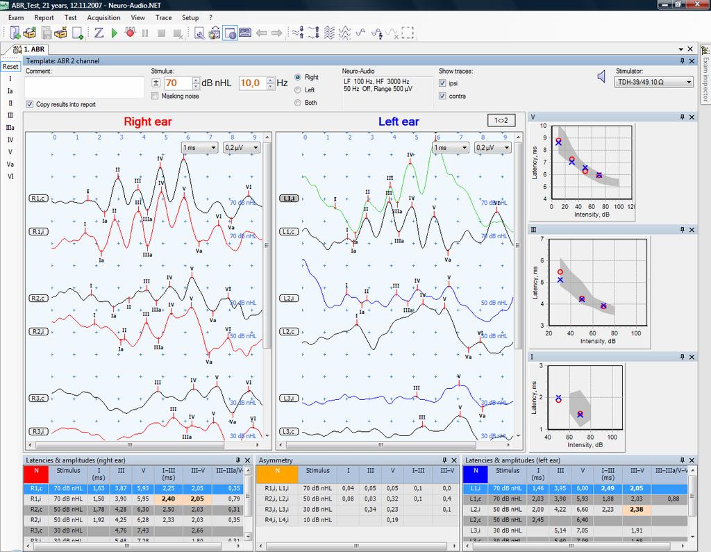 AEP Tests The general view of ABR test window is shown in Fig. 8.5. Fig. 8.5. ABR test window 8.4.1.