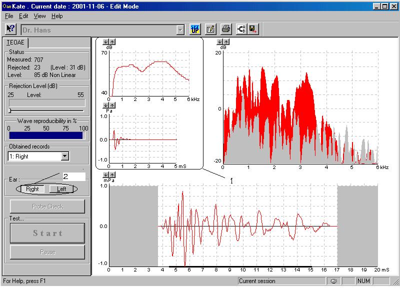 4.3.2.3 Recording of OAEs Once the desired stimulus characteristics have been obtained the recording of the OAE measurement can be initiated by pressing the 'Start' button. Figure 5.3.1 shows the test screen.