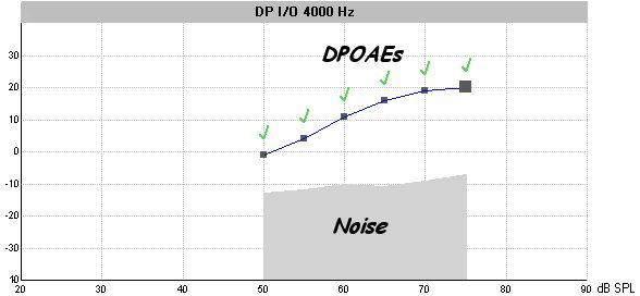 DP-gram/IO window DP-gram is used to check for DPOAEs at different frequencies at a specific level. All F 2 stimulus frequencies are listed on the horizontal x-axis [500-8000Hz].