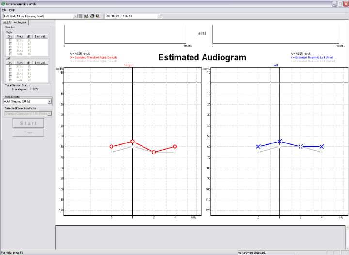 Result is an audiogram typically used to fit a hearing aid.