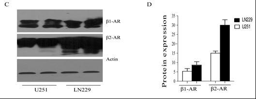 The Expression of β1 and β2 Adrenergic Receptor mrna in Glioma Cells.