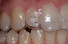 Private Practice for 6 years Actively treating Invisalign patients