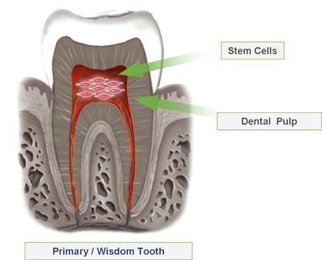 Dental Pulp Stem Cells DPSCs First described in 2000 by Dr.