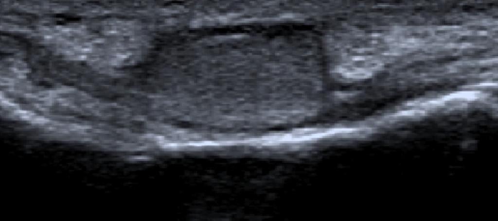 Fig. 7: Ultrasonographic image of the first