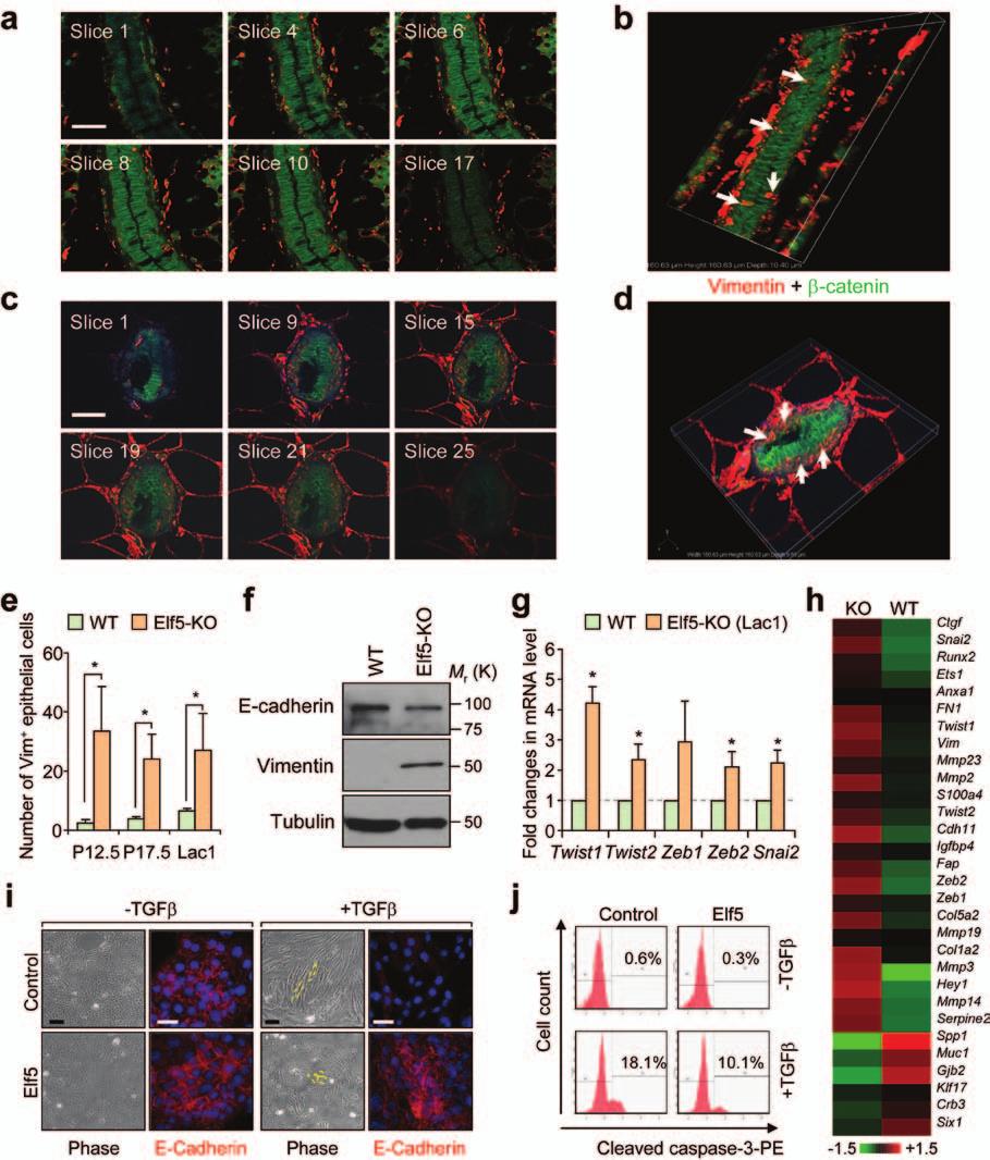 DOI: 10.1038/ncb2607 Figure S1 Elf5 loss promotes EMT in mammary epithelium while Elf5 overexpression inhibits TGFβ induced EMT. (a, c) Different confocal slices through the Z stack image.