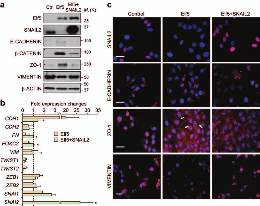 Figure S5 SNAIL2 overexpression restores the mesenchymal characteristics in MDA-231-Elf5 cells. (a) Western blot analysis of Elf5 and EMT markers expression.