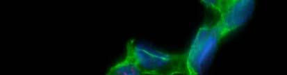 cells by imunofluorescence.
