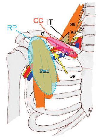 THE THORACIC OUTLET REGION Cervical spine Pectoralis minor inferior