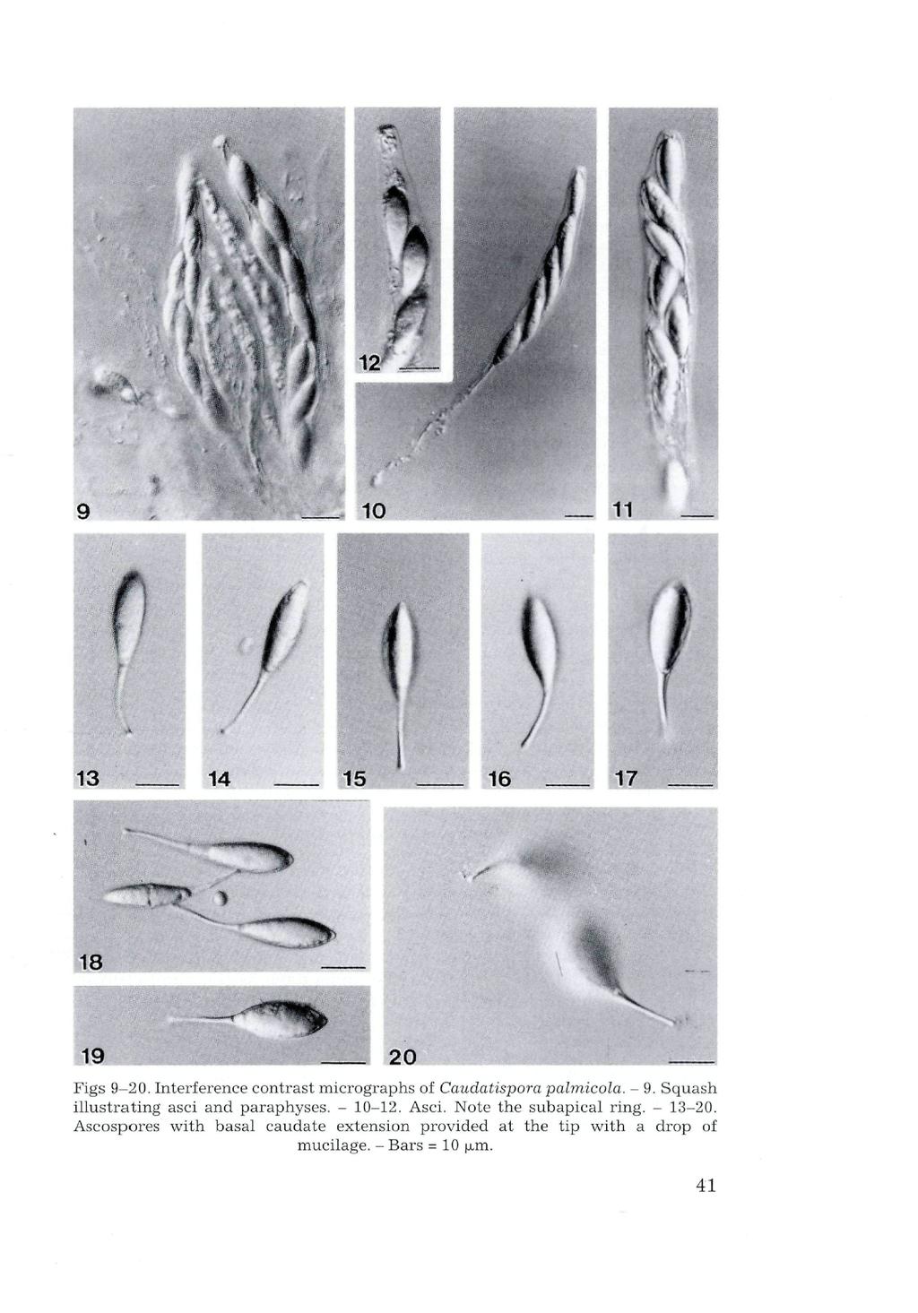 Verlag Ferdinand Berger & Söhne Ges.m.b.H., Horn, Austria, download unter www.biologiezentrum.a 19 Figs 9-20. Interference contrast micrographs of Caudatispora palmicola. - 9.