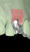 or away from the desired direction of abutment angle at the time of