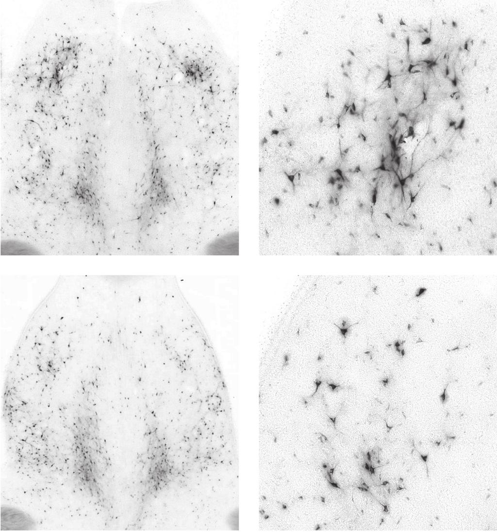 A C D B C-fos is a widely expressed gene, however its lack of expression in a brain region does not necessarily preclude neuronal activation (Labiner et al. 1993).