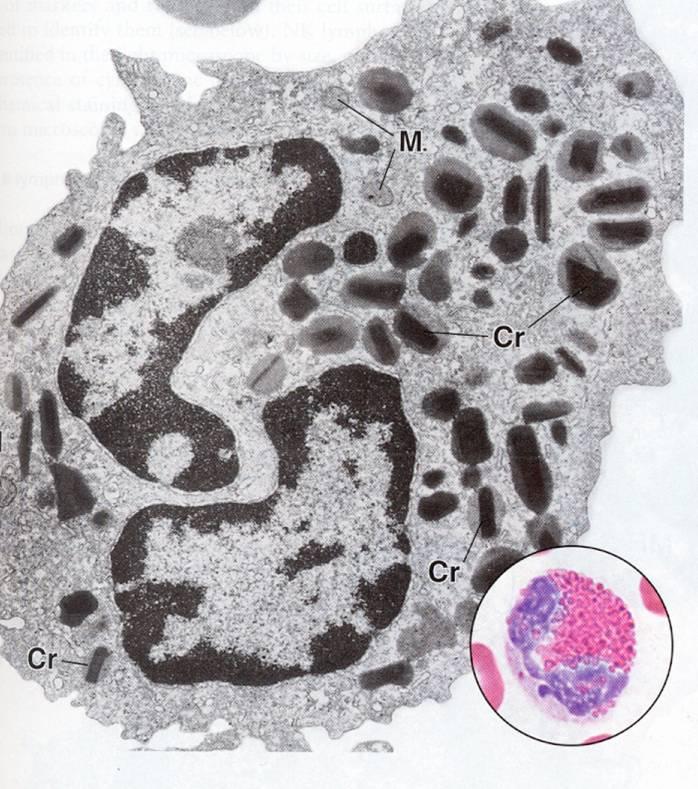 EM: --- granules: lysosome round or ovoid with cube-liked electron dense crystal contain: