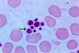 (3) blood platelet: ---source:;cytoplasmic fragment of megakaryocyte in bone marrow ---normal number: 100-300 10 9 /L