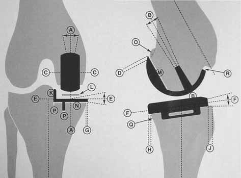 712 S. COOL, J. VICTOR, TH. DE BAETS Fig. 2. Measurements of implant position (instructions from the manufacturer). Alignment of tibial component E. Coronal plane position : mean absolute value 1.