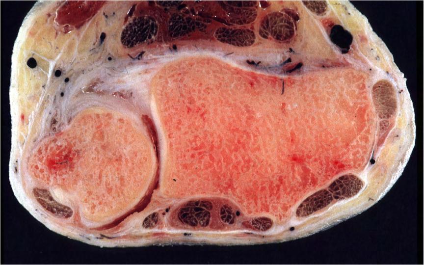 Anatomy of the ulnar