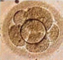 reproductive technologies Cryopreservation of sperm IVF ISI