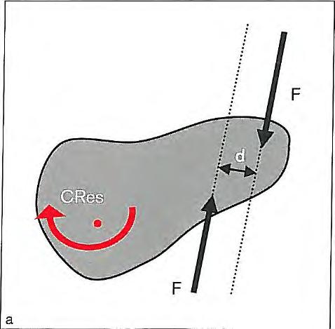 Fig 1-12 A force having a line of action passing through the center of resistance (CRes) causes translation of the tooth.