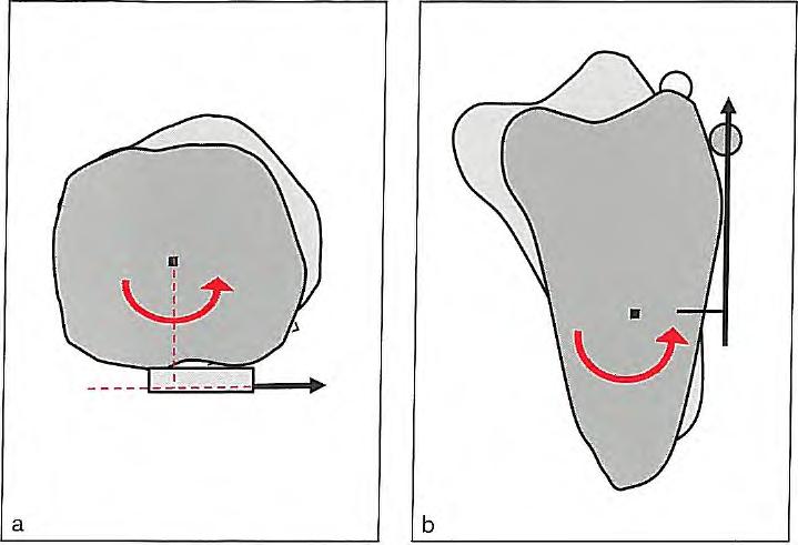 2 i Application of Orthodontic Force Fig 2-33 (a) The line of action of the elastic force applied to the mandibular molar passes buccally to the center of resistance.