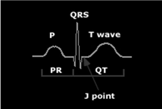 QRS Axis Look at leads I and avf to determine which quarter. Then find the limb lead with equal negative and positive forces and your axis will be perpendicular to that lead.