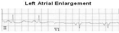 Confirm voltage/paper speed Rate and Rhythm Ventricular Axis Intervals Individual Waves Atrial Enlargement Atrial