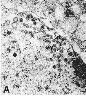 herpesvirus MDV in nucleus R.L.