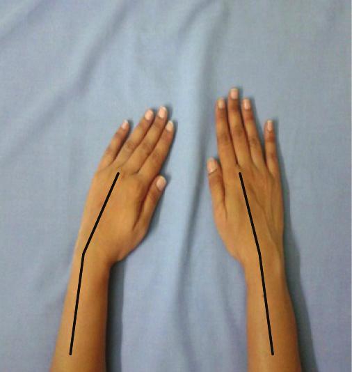 decreased Figure 3: Right wrist