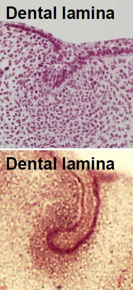 + Tooth development (Odontogenesis) Initiation stage Begins between 6 th to 7 th weeks, FIRST stage Induction :the mesenchymal tissue
