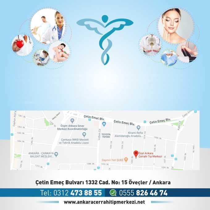 Our organization, operating under the name of Özel Ankara Cerrahi Tıp Merkezi (Private Ankara Surgery Medical Center), provides services to patients with its understanding of management adopting