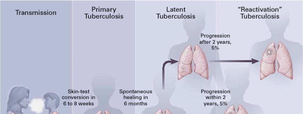 Tuberculosis transmission