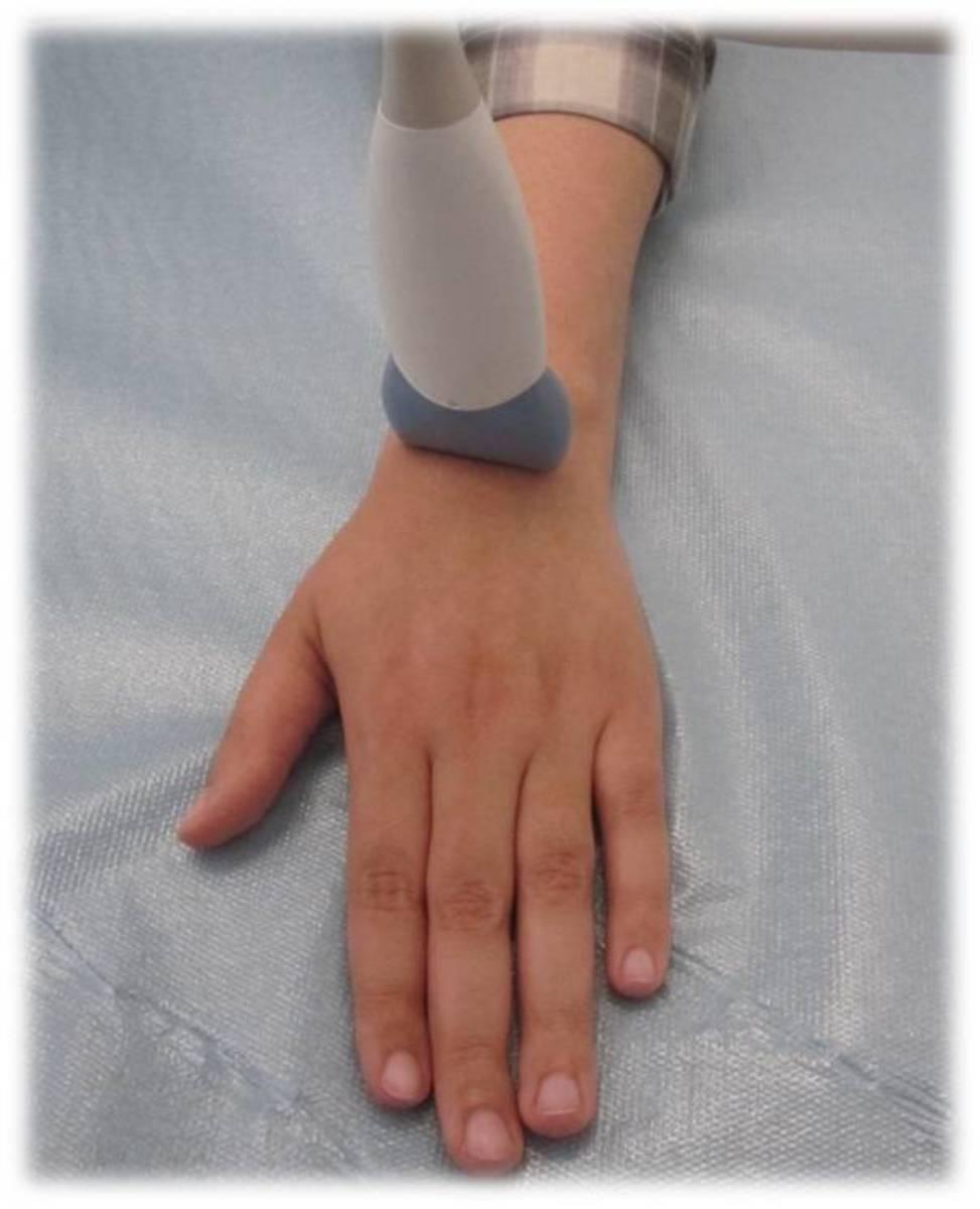 Fig. 7: Probe transverse to dorsal aspect of wrist: -