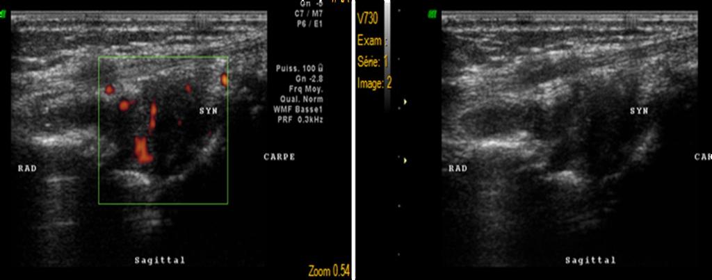 16: B-mode and colour Doppler ultrasonography examined