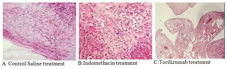 Treatment of Rheumatoid Arthritis with Biological Agents http://dx.doi.org/10.