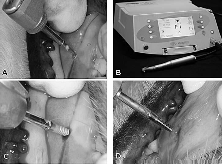 ROTATIONAL RESISTANCE OF SLA MINI-IMPLANTS 901 Figure 2. Placement procedure of mini-implant. (A) Cortical penetration using guide drill.