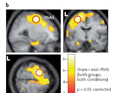 EFFECT OF rtms ON MOTOR CORTEX EXCITABILITY Ridding & Rothwell, Nature Revievs