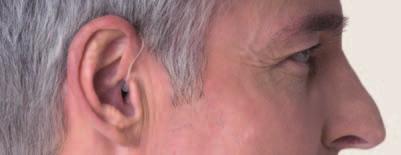 A distinction is made between the following designs: Behind-the-ear hearing systems (BTE): BTE hearing systems are worn behind the ear and are connected to the auditory canal