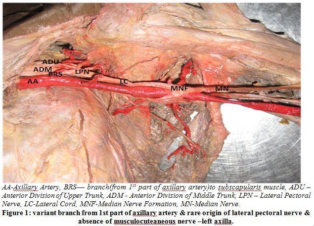 above muscles and descends as lateral cutaneous nerve of forearm. Number of variations in the course and distribution of the musculocutaneous nerve have been reported.