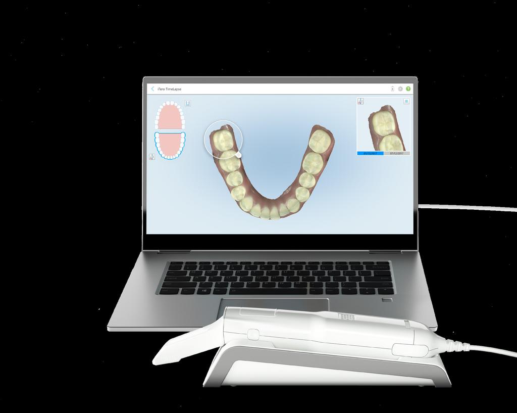 start-ups than the current itero Element scanner1 Stunning 3D scans for chairside consults with compatible laptops3 Expanded 21.