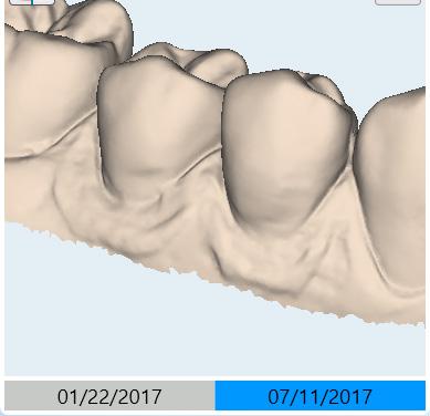 gingival recession is progressing and so much more all in real-time.